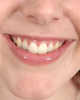 XX Cel - 38-Aw_003_p_038